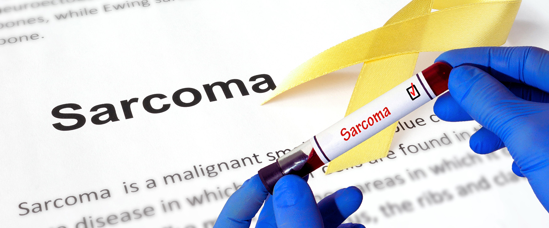 Sarcoma immunotherapy trial SRC8 opens across Canada