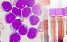 The ALC10 study has opened, assessing treatment approaches in older adults with acute myeloid leukemia 