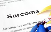 Sarcoma immunotherapy trial SRC8 opens accross Canada