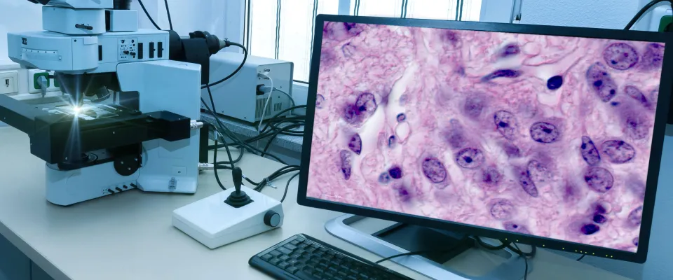 CIHR has announced $3,056,176 in funding over 5 years, for the TACtful trial 